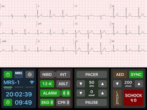 MRS Pro EKG